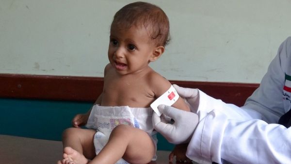 coronavirus pandemic made Yemen's health system even worse.