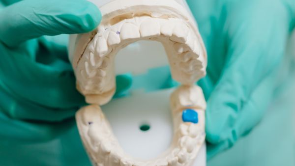 طبيب البوابة: أسباب وطرق علاج ألم ضرس العقل