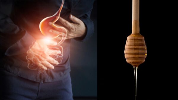 طبيب البوابة: العلاجات المنزلية للقرحة