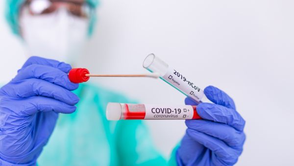 PCR test