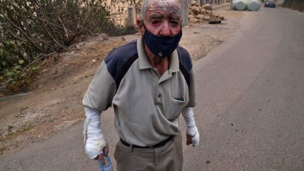 الاف عناصر الحماية يشاركون في اخماد النيران