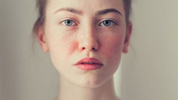 لمكياج خال من العيوب.... هذه أفضل منتجات لأولئك الذين يعانون من الوردية