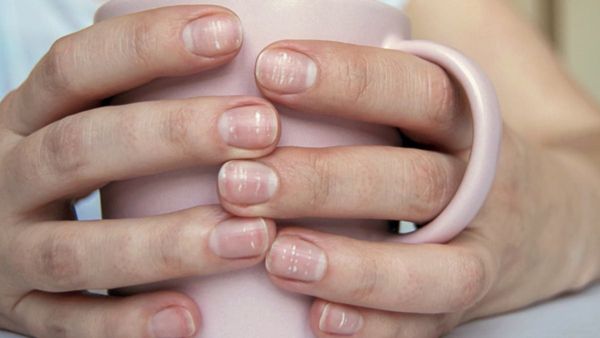  كيف تمنعين ظهور البقع البيضاء على أظافرك؟
