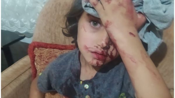 أتراك يعتدون على لاجئين سوريين في أنقرة