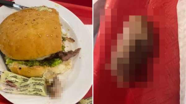 أصبع بشري في ساندوتش برجر