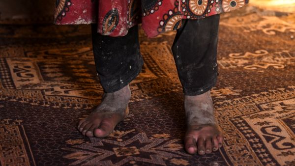 UN agencies say almost 23 million in Afghanistan face hunger this winter