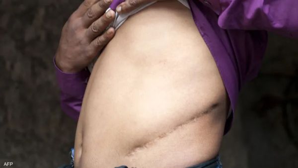 البت بأكبر قضايا الإتجار بالبشر وبيع الأعضاء بمصر