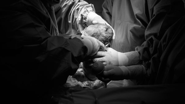 Doctors’ Union Blames the Women instead of the practitioners Greed 