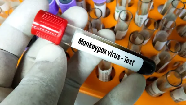 WHO says it's 'not concerned' about monkeypox outbreak turning into pandemic