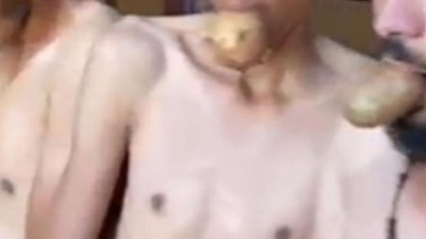 االعتداء بالضرب على 14 عاملا في لبنان