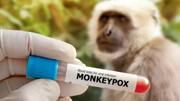 monkeypox