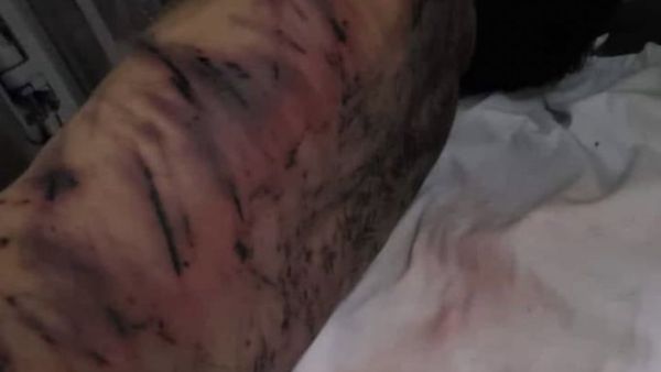Syria's Bashar Abd Al Saud, tortured to death