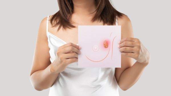 أول علامات سرطان الثدي ظهوراً