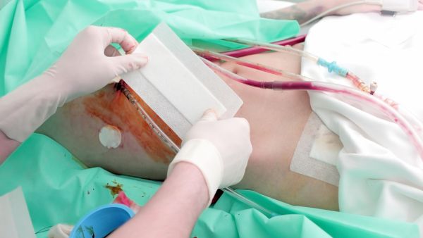 اردني يبيع كليته في تركيا