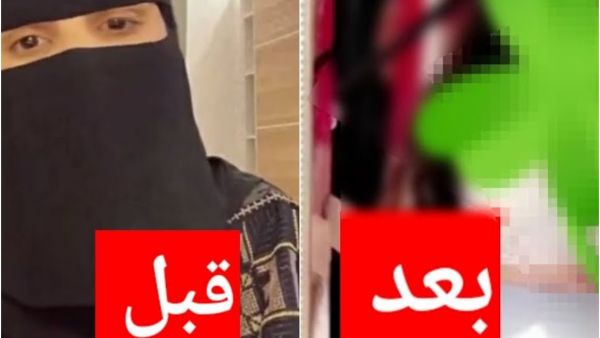 زهور سعود قبل وبعد