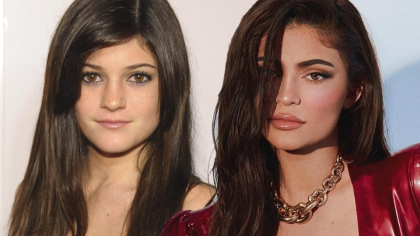 Kylie says she has not done many plastic surgeries