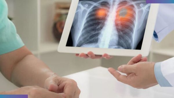 افضل دكاترة صدرية في الرياض