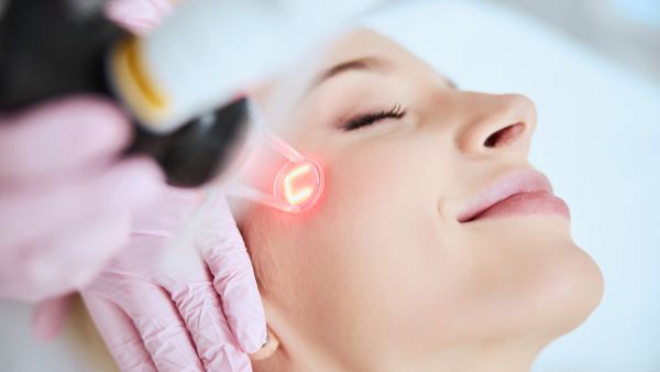 Laser skin resurfacing