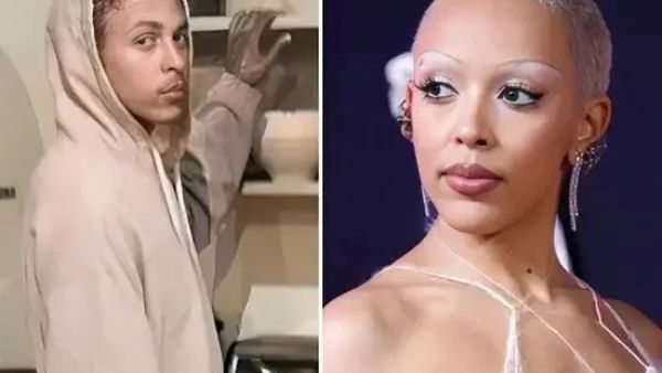 Doja Cat’s brother allegedly 'knocked out' her teeth, her mother says in restraining order petition. (X)