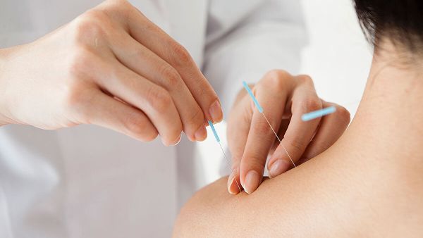 أفضل مركز للعلاج بالابر الصينية في دبي: 7 مراكز رائعة ننصحك بها