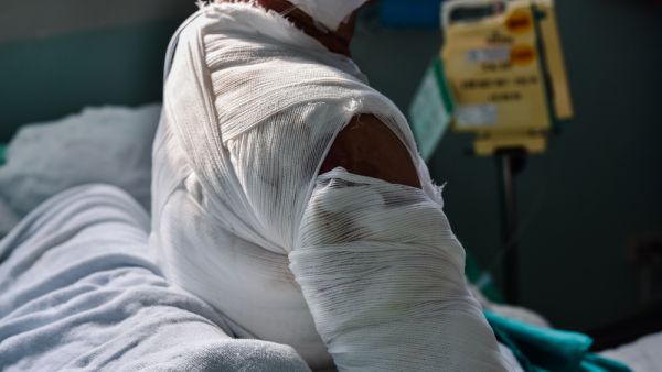 Man sets himself on fire after his mother rejected his fiancé
