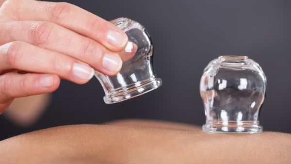 أفضل أوقات لعمل الحجامة في رمضان، وهل تفطر ؟