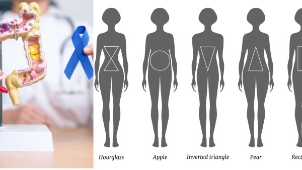 Body shape