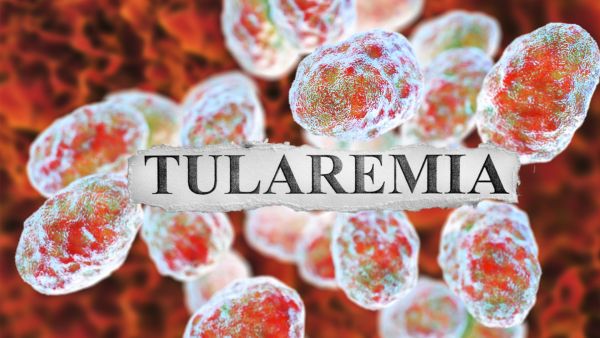 Tularemia disease