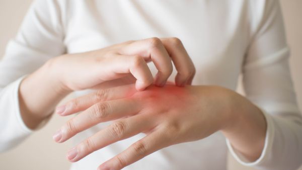 skin allergies