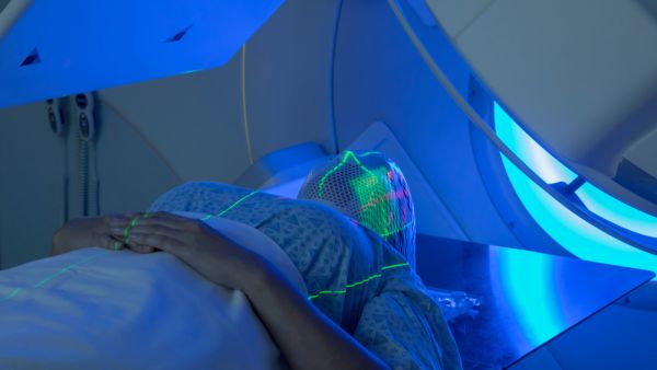 radiation therapy