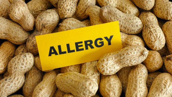 food allergies