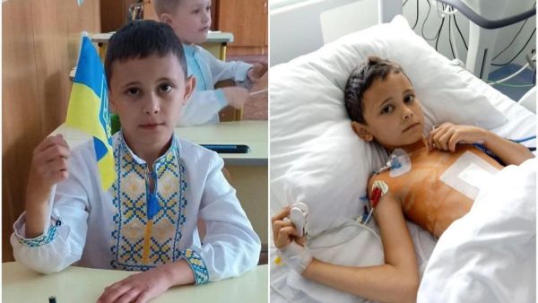 Ukrainian child who was at okhmatdy hospital dies days after Russian attack