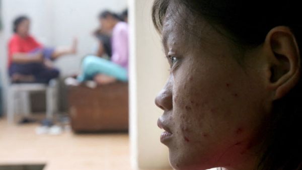 WHO declares Mpox a global health emergency