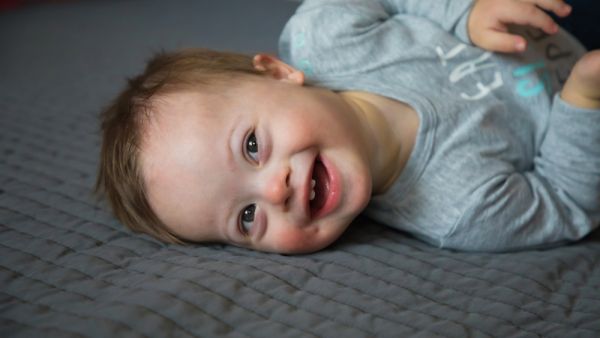 Down Syndrome baby