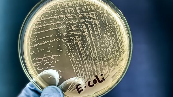 E coli
