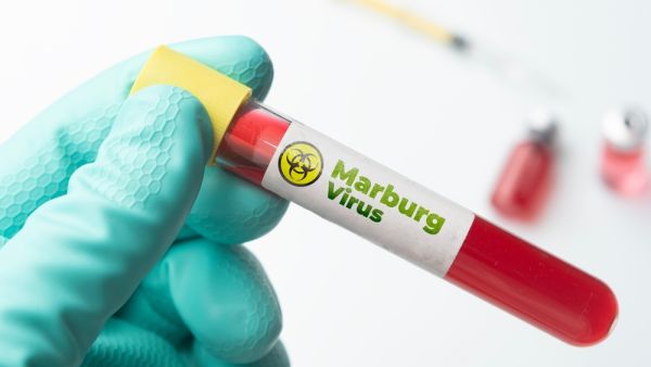 Marburg virus