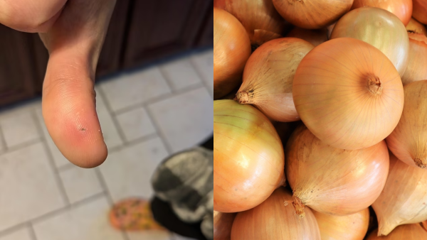 Onion