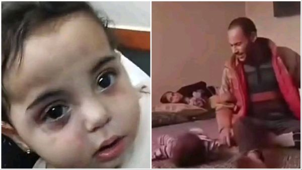 Syrian girl Yasemin