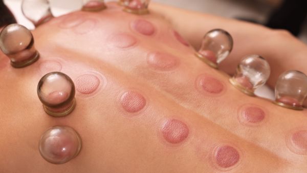 أفضل وقت لعمل الحجامة في شهر ديسمبر 2025