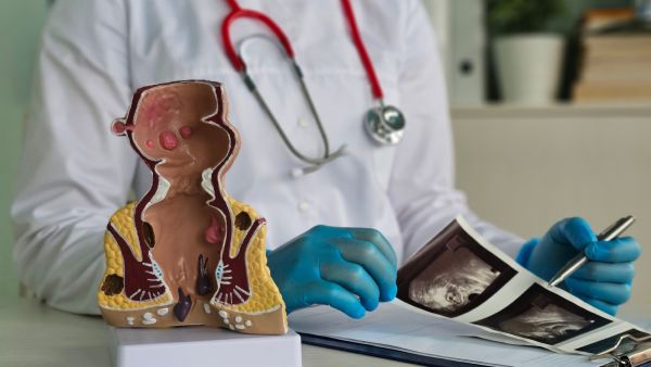 داء الرتوج: الأسباب والأعراض وطرق العلاج