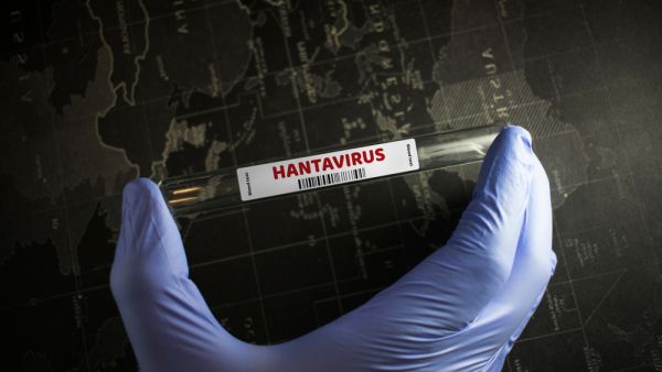 Hantavirus