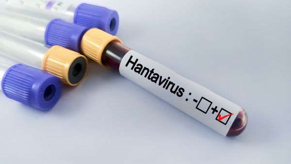 Hantavirus 