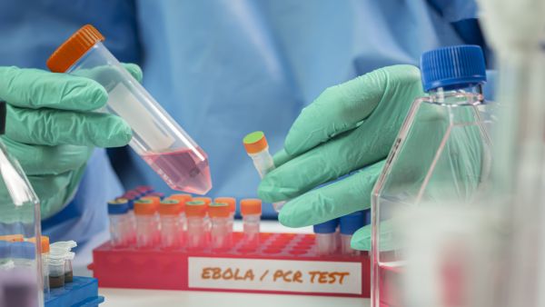فنيون صحيون يرتدون معدات وقاية أثناء إجراء فحص مخبري للكشف عن فيروس إيبولا داخل مختبر متخصص