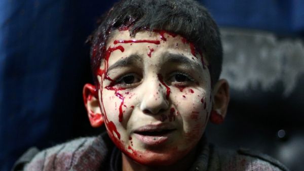 A file photo taken on February 02, 2015 shows an injured Syrian child waits for treatment at a makeshift hospital in the rebel held area of Douma, north east of the capital Damascus, following reported air strikes by forces loyal to President Bashar al-Assad. (AFP/Abd Doumany) A file photo taken on February 02, 2015 shows an injured Syrian child waits for treatment at a makeshift hospital in the rebel held area of Douma, north east of the capital Damascus, following reported air strikes by forces loyal to President Bashar al-Assad. (AFP/Abd Doumany)