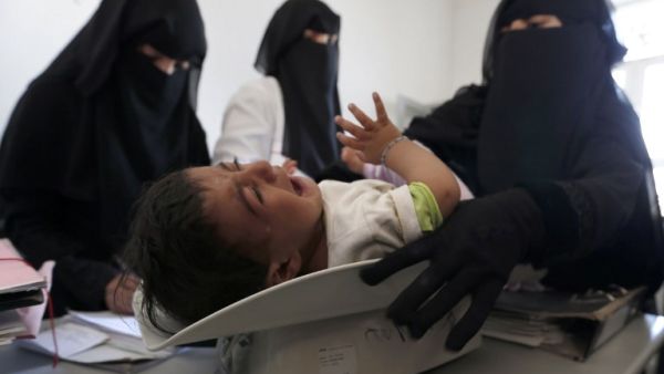 A Yemeni nurse weighs a child at a medical center on the outskirts of the Yemeni capital Sanaa, on Jan. 6, 2018 (MOHAMMED HUWAIS / AFP) 