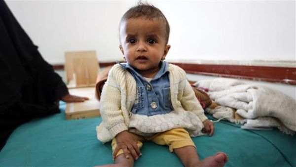 “Children in Yemen are suffering the devastating consequences of a war that is not of their making" (AFP/File)