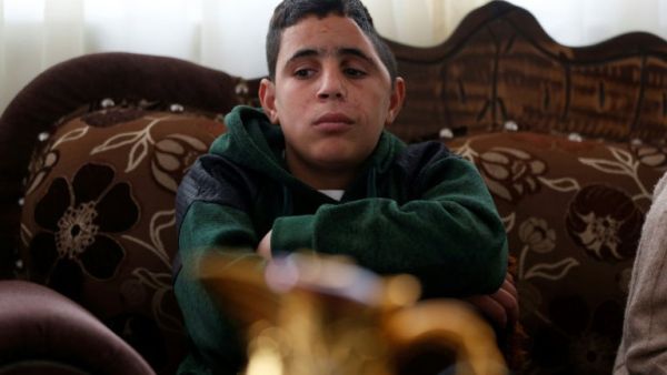 Mohammed Fadel Tamimi,Palestinian boy previously shot in the face and severely wounded by an Israeli soldiers (AFP/File Photo)
