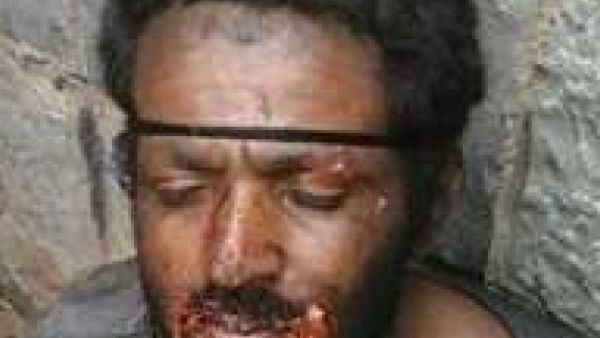 مصاص دماء الكلاب