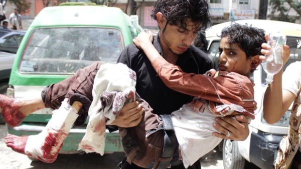 A man carries an injured child from fighting in Taiz (Source: AFP)