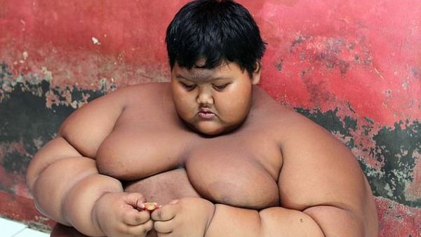 Arya Permana when weighing 31st 6lbs when he was just ten-years-old and had become Indonesia's fattest boy (dailymail)